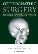 Farhad B. Naini - Orthognathic Surgery: Principles, Planning and Practice - 9781118649978 - V9781118649978