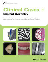 Nadeem Karimbux - Clinical Cases in Implant Dentistry - 9781118702147 - V9781118702147