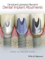 Hamid Shafie - Clinical and Laboratory Manual of Dental Implant Abutments - 9781119949817 - V9781119949817