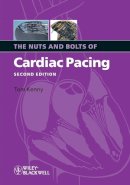 Tom Kenny - The Nuts and Bolts of Cardiac Pacing - 9781405184038 - V9781405184038