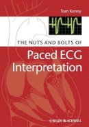 Tom Kenny - The Nuts and Bolts of Paced ECG Interpretation - 9781405184045 - V9781405184045