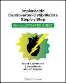 Roland X. Stroobandt - Implantable Cardioverter - Defibrillators Step by Step: An Illustrated Guide - 9781405186384 - V9781405186384