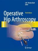 J.w. Thomas Byrd - Operative Hip Arthroscopy - 9781441979247 - V9781441979247