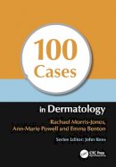 Rachael Morris-Jones - 100 Cases in Dermatology - 9781444117936 - V9781444117936