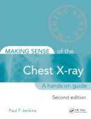 Paul F. Jenkins - Making Sense of the Chest X-ray - 9781444135152 - V9781444135152