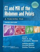Pablo R Ros - CT & MRI of the Abdomen and Pelvis: A Teaching File - 9781451113525 - V9781451113525
