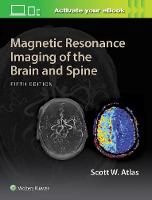 Scott W. Atlas - Magnetic Resonance Imaging of the Brain and Spine - 9781469873206 - V9781469873206