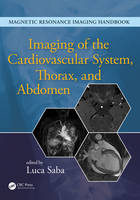 Luca Saba - Imaging of the Cardiovascular System, Thorax, and Abdomen - 9781482216264 - V9781482216264
