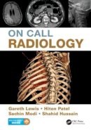 Gareth Lewis - On Call Radiology - 9781482221671 - V9781482221671