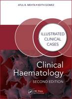 Atul Bhanu Mehta - Clinical Haematology: Illustrated Clinical Cases - 9781482243796 - V9781482243796