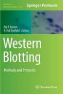 Biji T. Kurien (Ed.) - Western Blotting: Methods and Protocols - 9781493926930 - V9781493926930