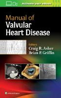 Craig R. Asher - Manual of Valvular Heart Disease - 9781496310125 - V9781496310125