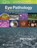 Ralph C. Eagle - Eye Pathology: An Atlas and Text - 9781496337177 - V9781496337177