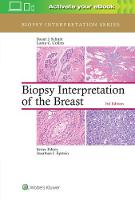 Stuart J. Schnitt - Biopsy Interpretation of the Breast - 9781496365750 - V9781496365750
