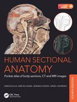 Adrian Kendal Dixon - Human Sectional Anatomy: Pocket atlas of body sections, CT and MRI images, Fourth edition - 9781498708548 - V9781498708548