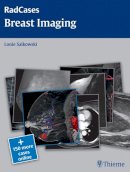 Lonie L. Salkowski - Radcases Breast Imaging - 9781604061918 - V9781604061918