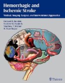 Bernard Bendok (Ed.) - Hemorrhagic and Ischemic Stroke: Medical, Imaging, Surgical and Interventional Approaches - 9781604062342 - V9781604062342