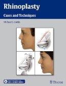 Michael S. Godin - Rhinoplasty - Cases and Techniques: Cases and Techniques - 9781604066807 - V9781604066807