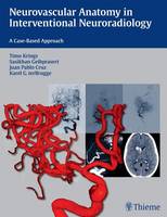 Timo Krings - Neurovascular Anatomy in Interventional Neuroradiology: A Case-Based Approach - 9781604068399 - V9781604068399