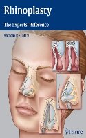 A P Sclafani - Rhinoplasty: The Experts´ Reference - 9781604068672 - V9781604068672
