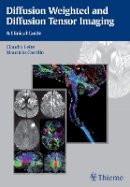 Claudia Leite - Diffusion Weighted and Diffusion Tensor Imaging: A Clinical Guide - 9781626230217 - V9781626230217