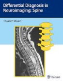 Steven Meyers - Differential Diagnosis in Neuroimaging: Spine - 9781626234772 - V9781626234772