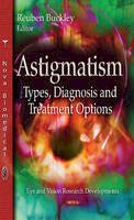 Reuben Buckley - Astigmatism: Types, Diagnosis and Treatment Options (Eye and Vision Research Developments) - 9781633219786 - V9781633219786