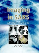 A.t. Ahuja - Imaging in SARS - 9781841102191 - V9781841102191