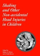 Robert A. Minns - Shaking and Other Non-Accidental Head Injuries in Children - 9781898683353 - V9781898683353