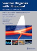 Doris Neuerburg-Heusler - Vascular Diagnosis with Ultrasound: Clinical Reference with Case Studies Volume 1: Cerebral and Peripheral Vessels - 9783131038326 - V9783131038326