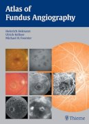 Heimann - Atlas of Fundus Angiography - 9783131405517 - V9783131405517