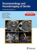 Jose Manuel Valdueza Barrios - Neurosonology and Neuroimaging of Stroke: A Comprehensive Reference - 9783131418722 - V9783131418722