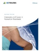 Peter Kloen - Concepts and Cases in Nonunion Treatment - 9783131658517 - V9783131658517