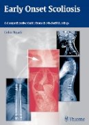 C Nnadi - Early Onset Scoliosis: A Comprehensive Guide from the Oxford Meetings - 9783131726612 - V9783131726612