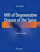D'Aprile, Paola - MRI of Degenerative Disease of the Spine: A Case-Based Atlas - 9783319094465 - V9783319094465