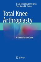 Rodr Guezmerch N - Total Knee Arthroplasty: A Comprehensive Guide - 9783319175539 - V9783319175539