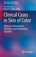 Porcia Bradford Love (Ed.) - Clinical Cases in Skin of Color: Adnexal, Inflammation, Infections, and Pigmentary Disorders - 9783319223919 - V9783319223919