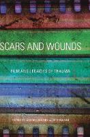 Nick Hodgin (Ed.) - Scars and Wounds: Film and Legacies of Trauma - 9783319410234 - V9783319410234