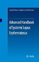 Laurent Arnaud - Advanced Handbook of Systemic Lupus Erythematosus - 9783319430348 - V9783319430348