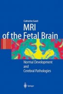 C. Garel - MRI of the Fetal Brain - 9783642622755 - V9783642622755