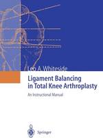 Leo A. Whiteside - Ligament Balancing in Total Knee Arthroplasty: An Instructional Manual - 9783642639241 - V9783642639241