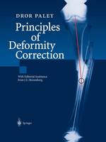 Dror Paley - Principles of Deformity Correction - 9783642639531 - V9783642639531