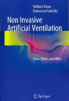 Nava, Stefano, Fanfulla, Francesco - Non Invasive Artificial Ventilation: How, When and Why - 9788847055254 - V9788847055254